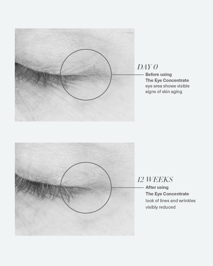 The Eye Concentrate 15ml - 图片 4